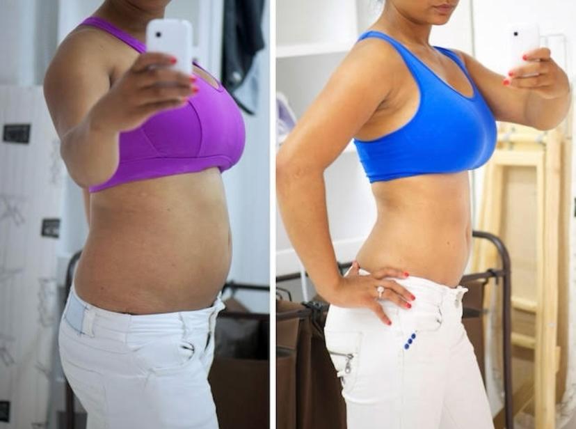 Antes e depois