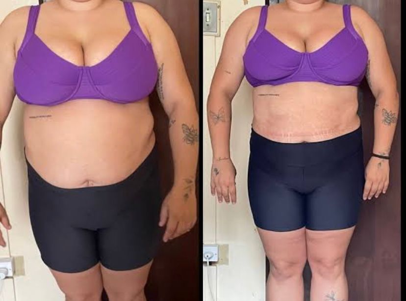 Antes e depois